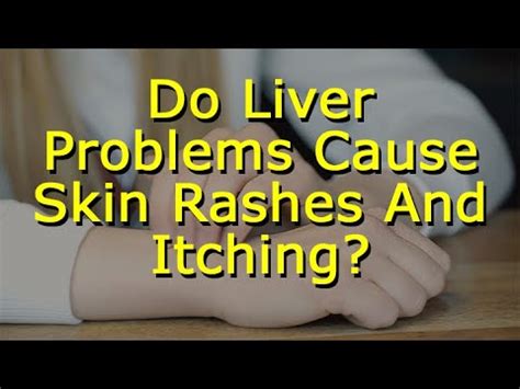 - A devastating itching of the skin driven by severe liver disease turns out to have a surprising cause. . Can liver detox cause itching